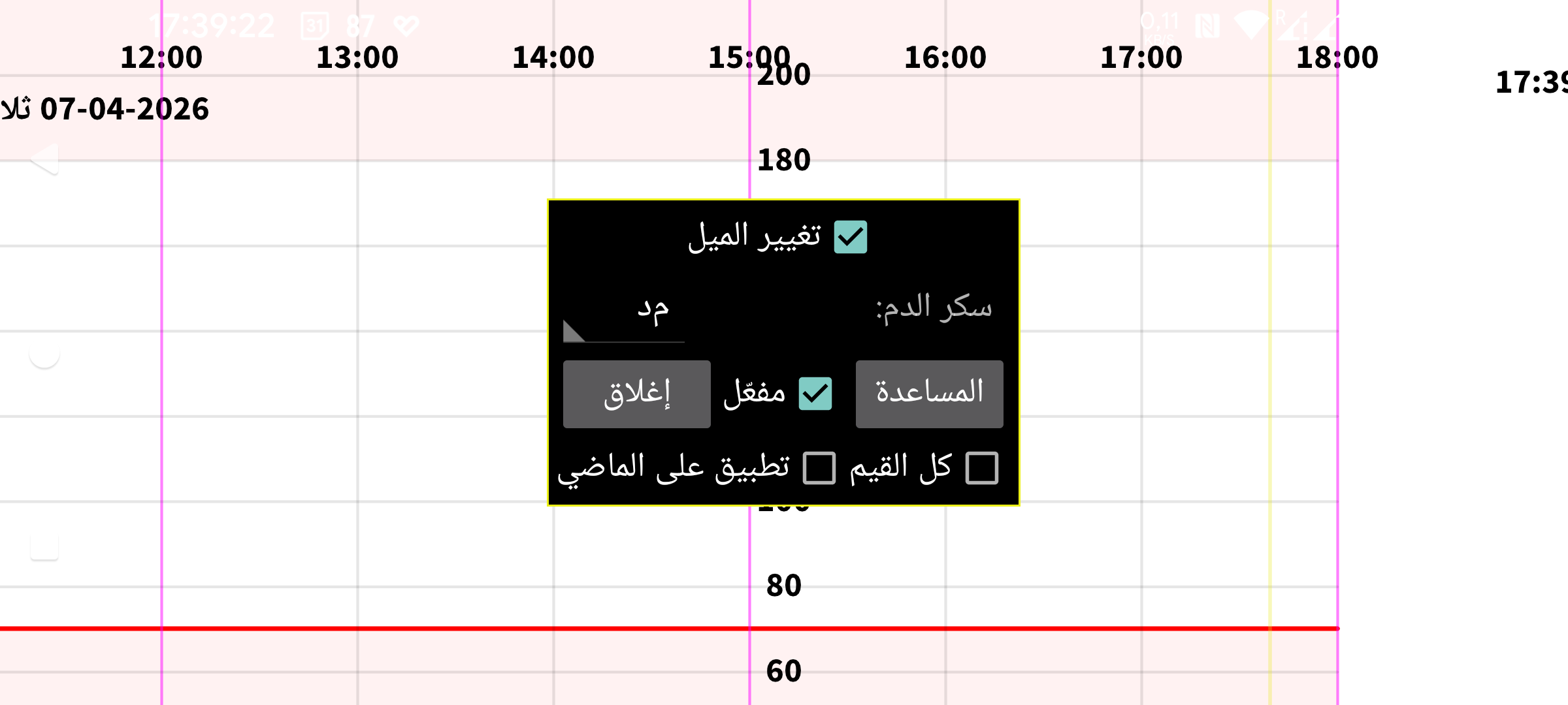Calibration Settings